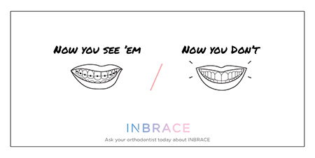 Inbrace