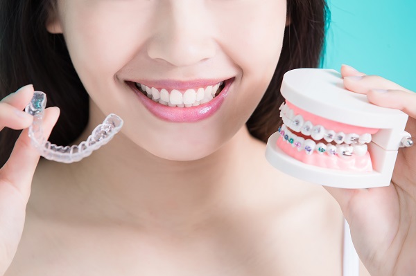 How Long Do Cosmetic Braces Take To Straighten Teeth?