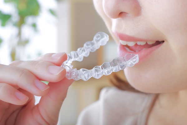 What To Consider When Looking For &#    ;Invisalign Near Me&#    ;