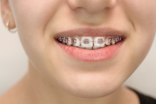 Tips From A Kids Orthodontist On Managing Braces Pain