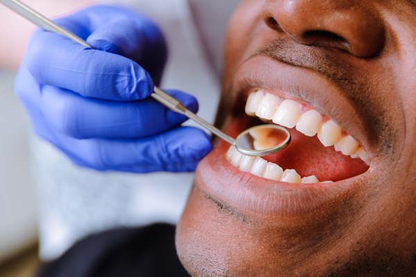 Which Teeth Straightening Option is Right for You? - FitSmiles