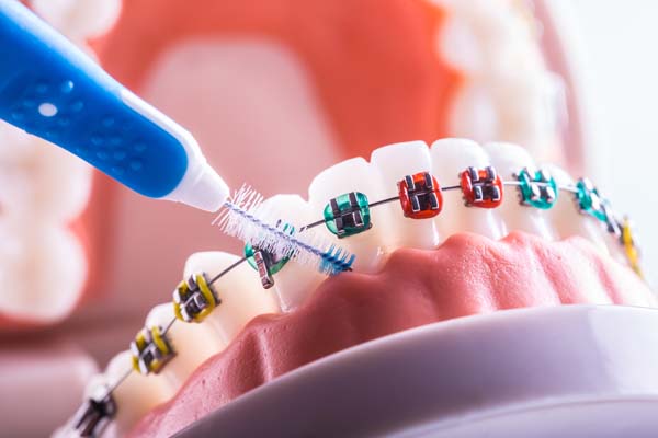 How An Orthodontist Can Help Improve Speech And Chewing Through Bite Correction