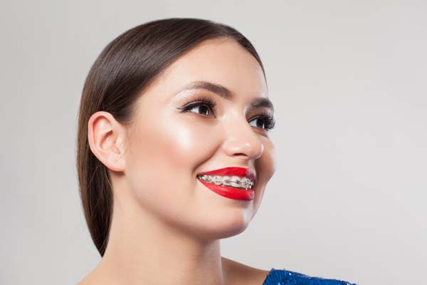 Aligners Make Teeth Straightening For Adults Easier Than Ever Before